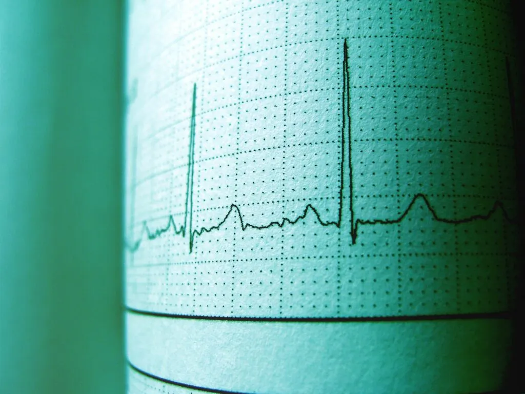 Cardiologii recomandă pește gras de două ori pe săptămână pentru inimă