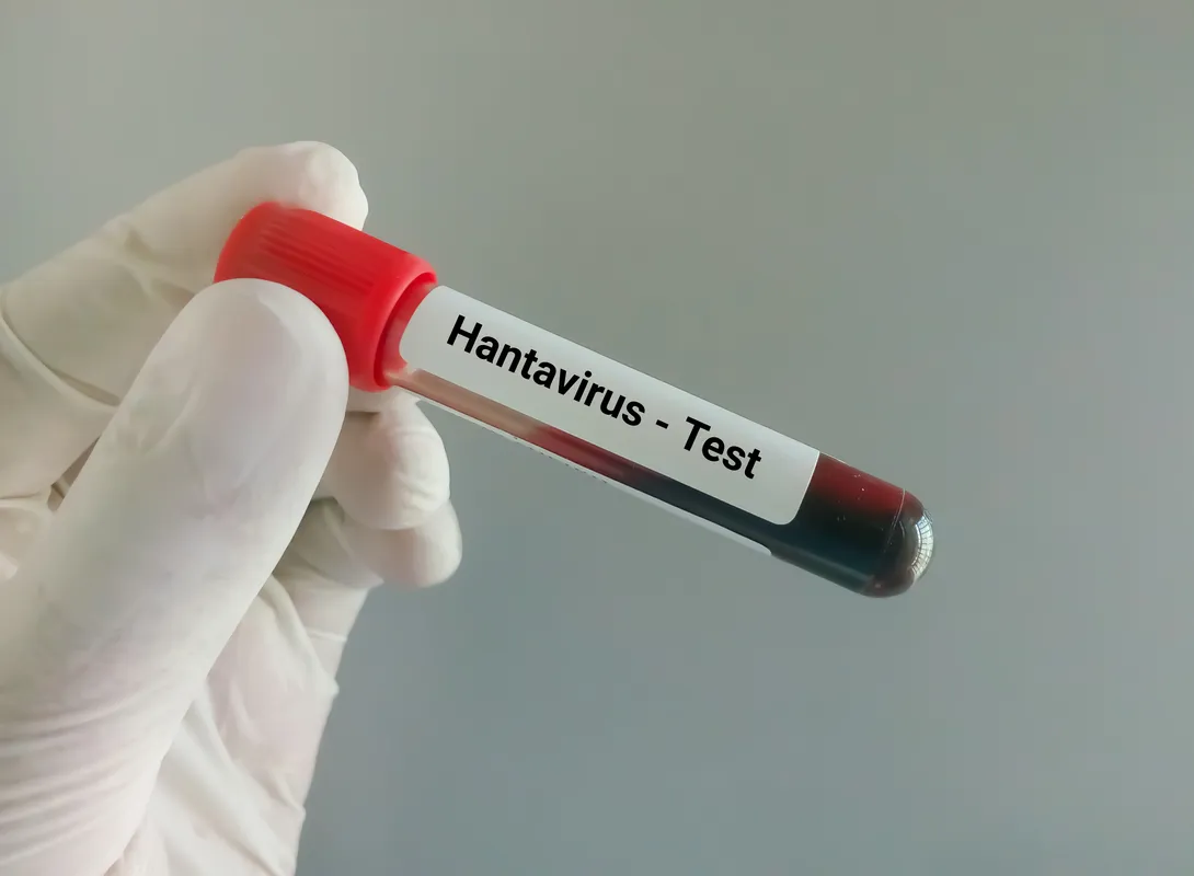 Suspiciune de hantavirus în România - anchetă epidemiologică în Arad și Bihor