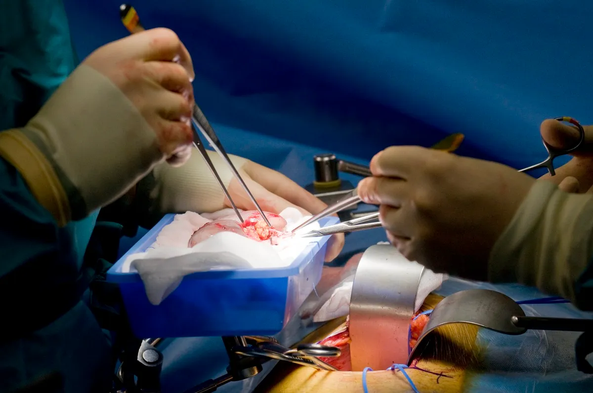 Rinichi de porc transplantat a funcționat 271 de zile în corpul unui pacient din SUA