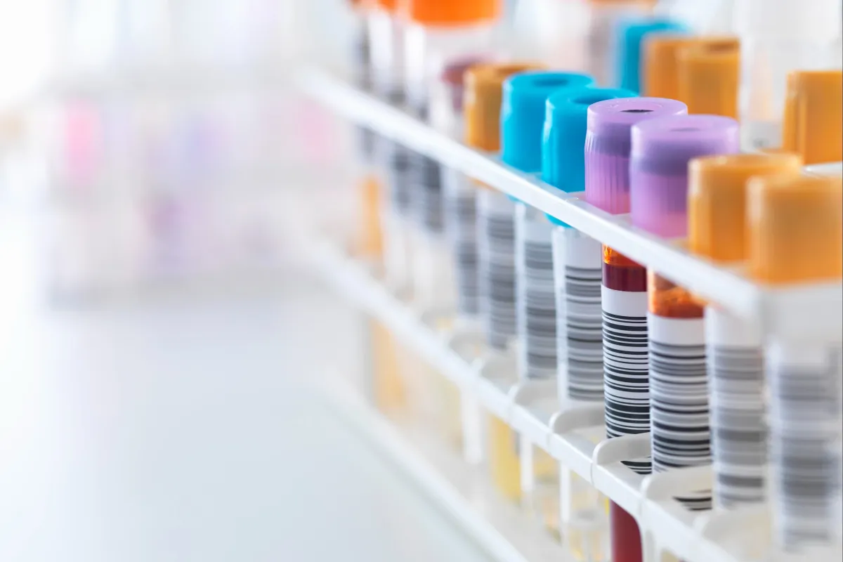 România, pe locul 4 în UE la diagnostice HIV depistate tardiv, arată datele ECDC