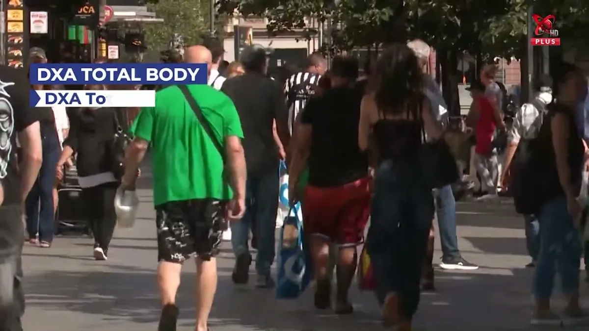 Cum se măsoară compoziția corporală: investigația DXA Total Body